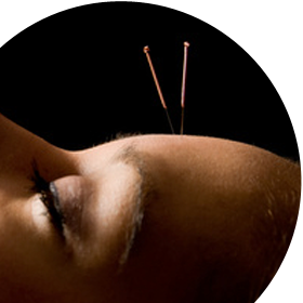 Bild "TCM:akupunktur.png"